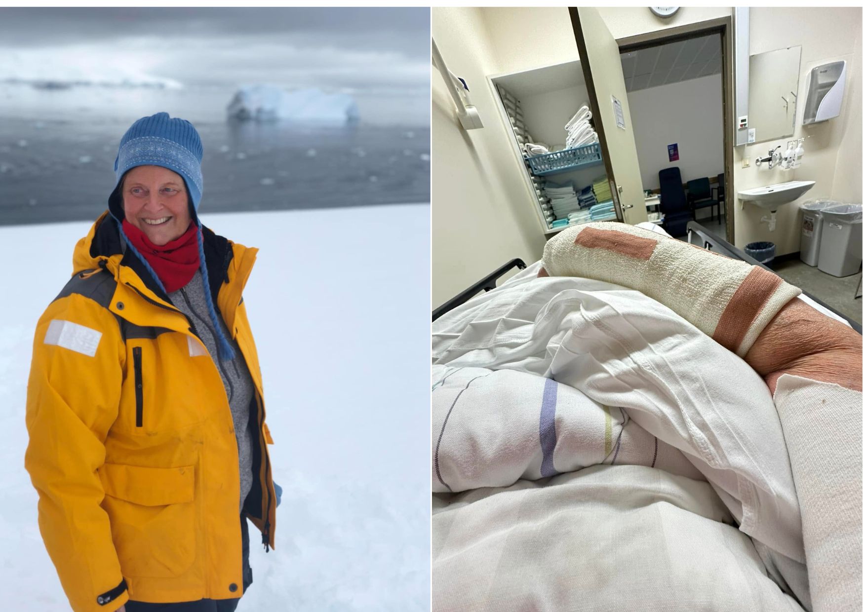 Carol handleggsbrotnaði á fyrsta degi Íslandsheimsóknar – Bjargvætturinn Þór bar hana af fjallinu