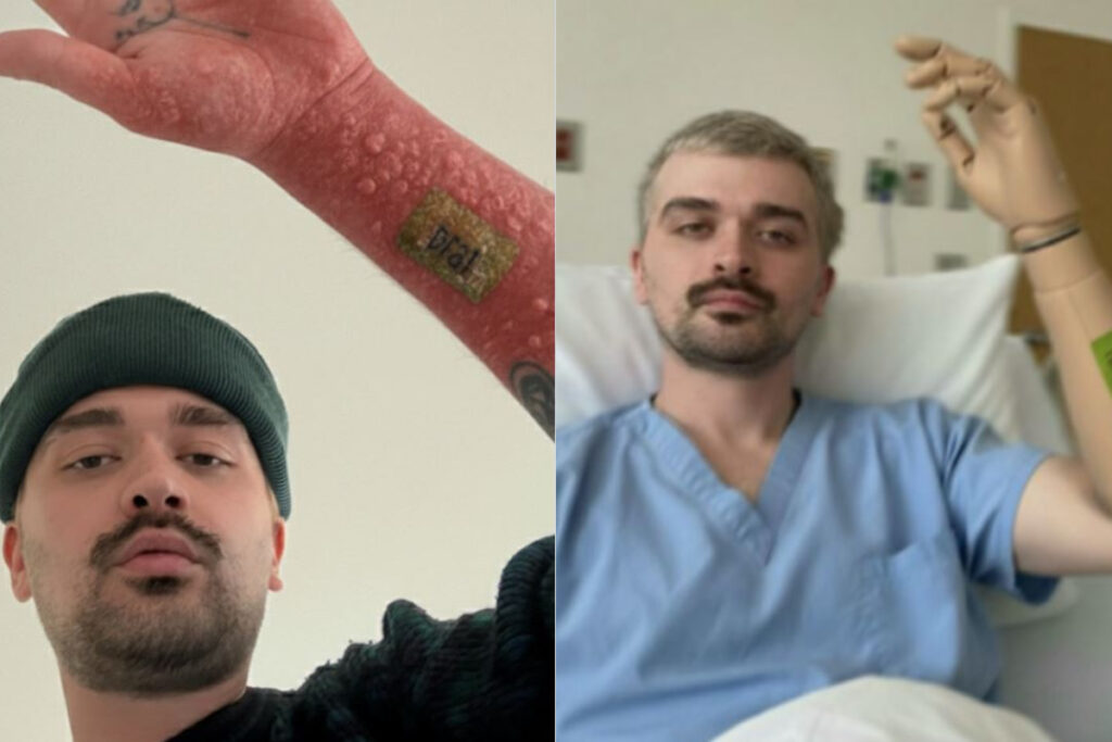 Fékk sér húðflúr á klósettinu á Laufeyjar tónleikum og endaði á spítala – „Þetta er hryllilega sárt“