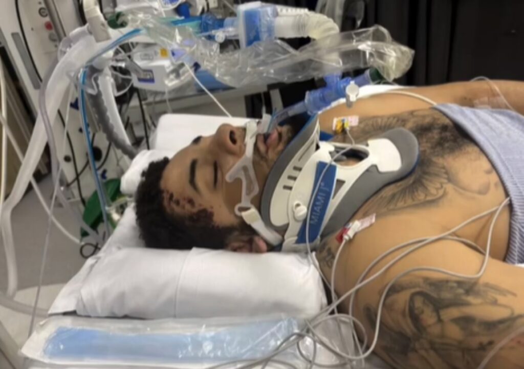 Kona ákærð eftir ölvunarakstur – Fórnarlamb hennar missti löppina og var haldið sofandi