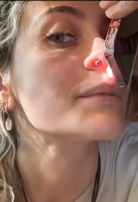 Dóttir goðsagnarinnar með gat í miðsnesinu eftir stífa eiturlyfjaneyslu