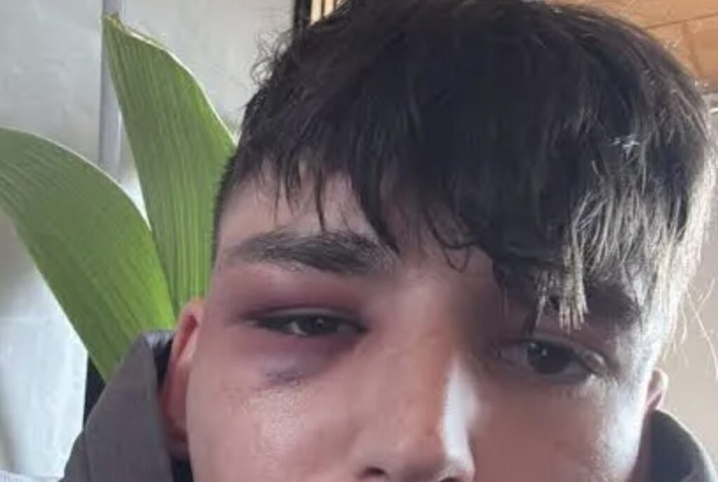 Buffaður á heimili sínu eftir að hann kom úr skápnum – Lögreglan hafði sagt honum að hlusta ekki á hótanir