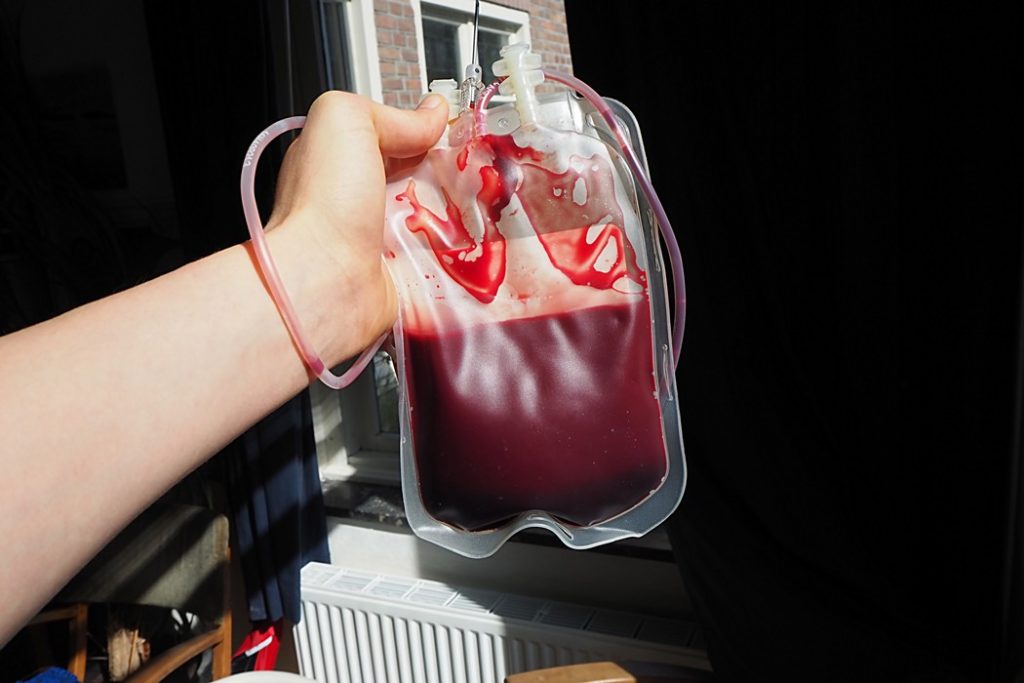 Greindist fyrst á níræðisaldri með „keltnesku bölvunina“ sem margir Íslendingar þekkja – „Þvílíkur léttir“