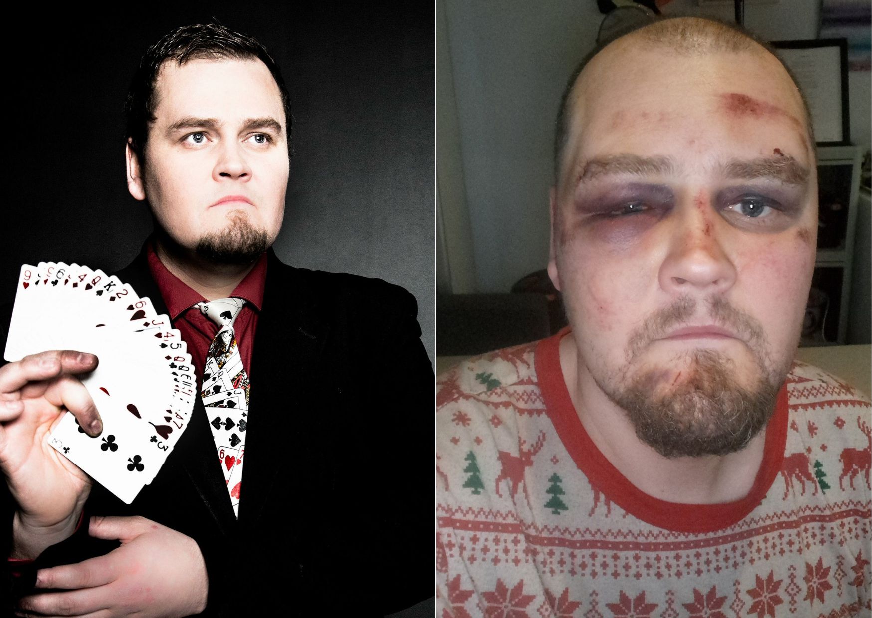 Daníel Örn er á batavegi eftir fólskulega og tilefnislausa líkamsárás – „Einbeittur brotavilji og ekkert annað“