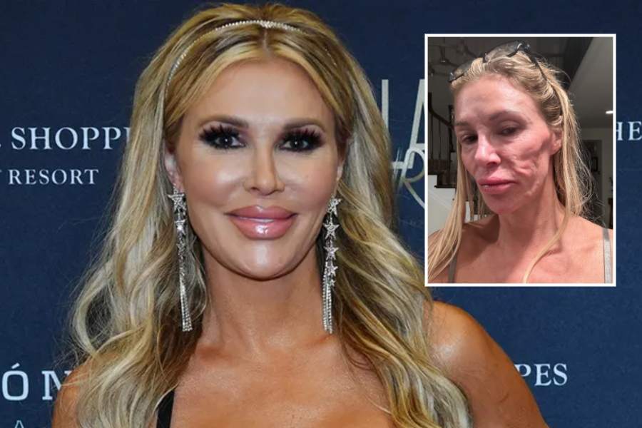 Raunveruleikastjarnan útskýrir hvernig hún afskræmdist í framan – „Það er glatað að eldast um 20 ár á einu bretti“