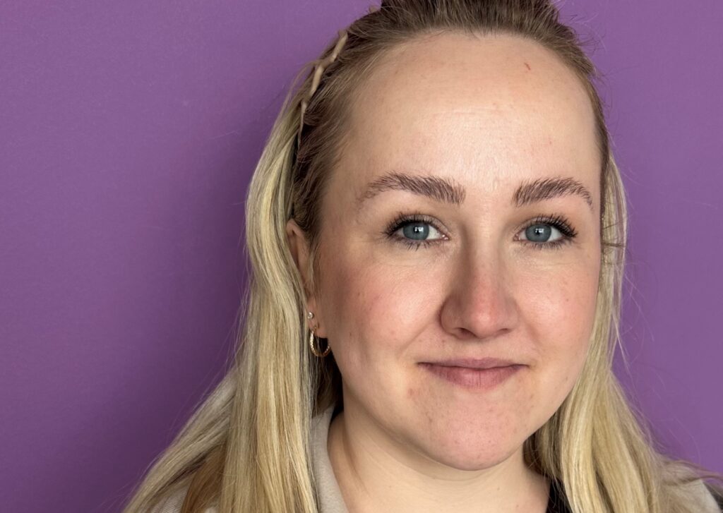 Brynja sá rauðu flöggin en sonur hennar ekki: „Ég sagði stopp þegar hann kom heim með glóðarauga“