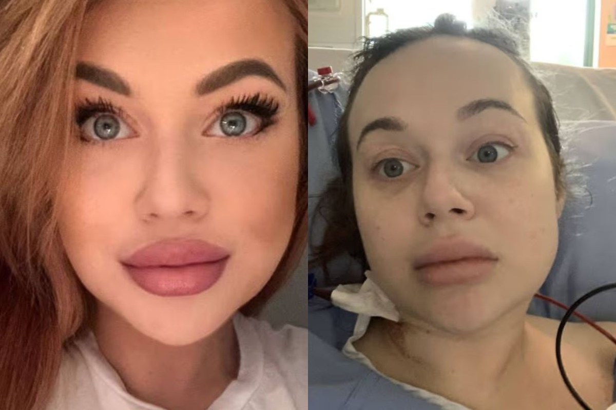 Ung móðir lenti í óhugnanlegri reynslu eftir fyllerí – „Af hverju get ég ekki hreyft fæturna?“