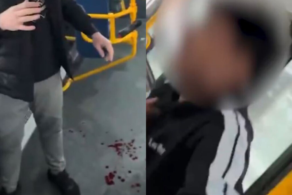 Hnífaárás í strætisvagni – Myndband náðist af unglingum skera fullorðinn mann