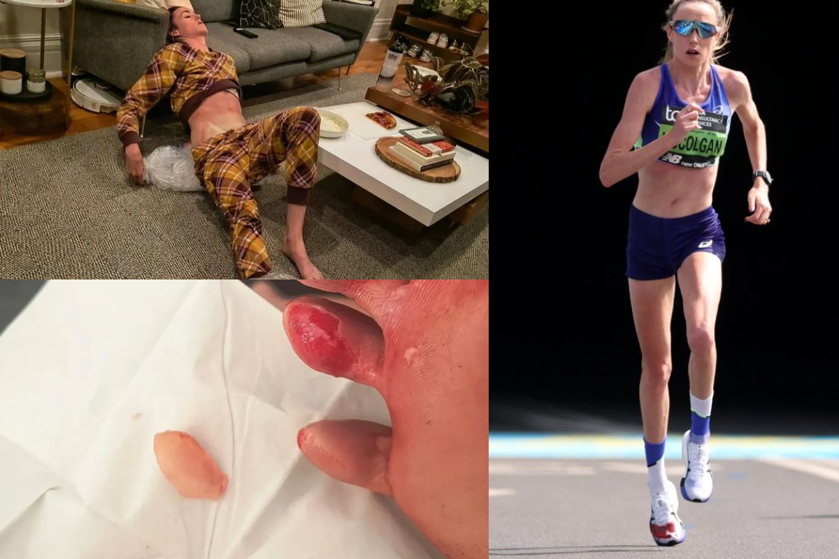 Fótur hlaupakonu í Londonmaraþoninu „sprakk“ – Skórinn alblóðugur